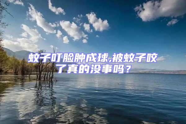 蚊子叮臉腫成球,被蚊子咬了真的沒事嗎?
