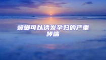 蟑螂可以誘發孕婦的嚴重哮喘