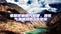 老鼠咬破燃?xì)饽z管,液化氣泄漏燒傷3歲女孩